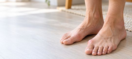 Vbočený palec: Proč vzniká, koho nejčastěji trápí a jak si ulevit?